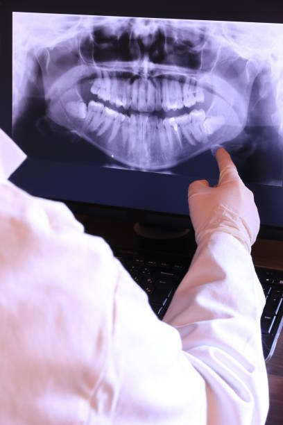 Best Emergency Wisdom Tooth Extraction in Loudoun Lley Estates, VA